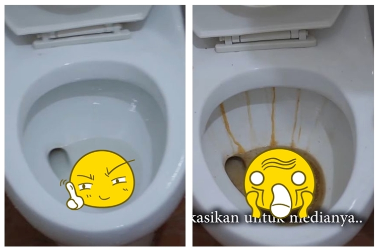 Trik menghilangkan kerak membandel di kloset tanpa diamplas, cukup andalkan 2 bahan dapur