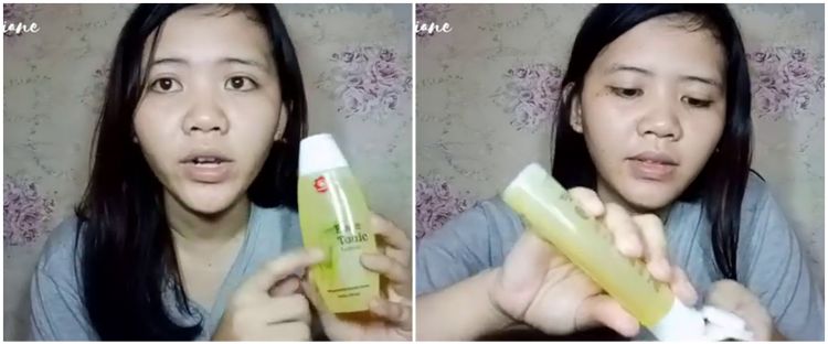 Tak perlu laser ratusan ribu, cara hilangkan milia di wajah ini ekonomis cuma pakai produk Rp7 ribuan