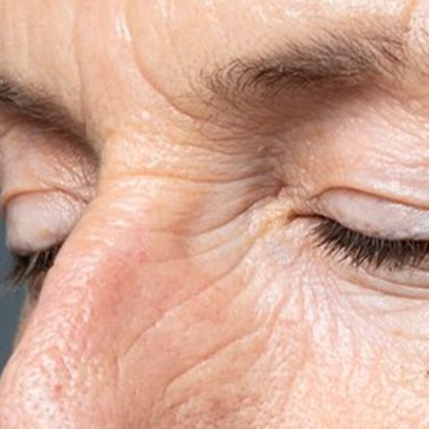 Hasilnya bak dibotox, ini cara hilangkan garis halus dan keriput di wajah cuma dengan 1 jenis buah