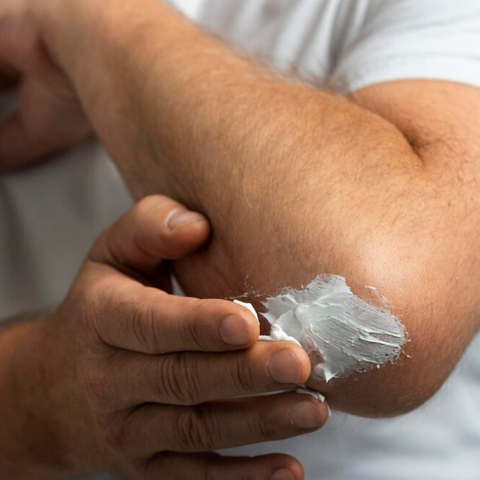 Cara mencerahkan lutut dan siku menghitam dalam 7 hari, kulit auto putih tanpa produk klinik