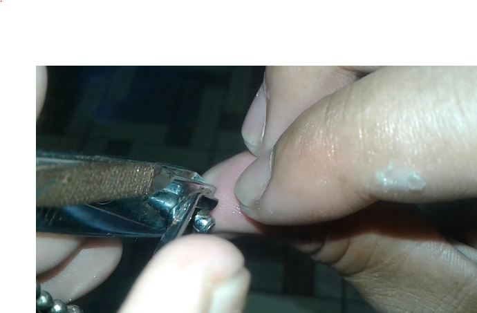 Trik mudah mengeluarkan duri ikan di tangan tanpa rasa sakit ditusuk jarum, aman pakai 1 bahan dapur