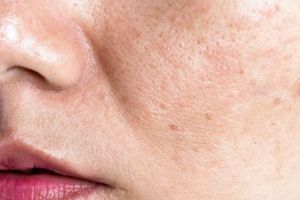 Nggak ribet beli skincare, begini cara meratakan warna kulit dari flek hitam pakai 1 jenis minuman