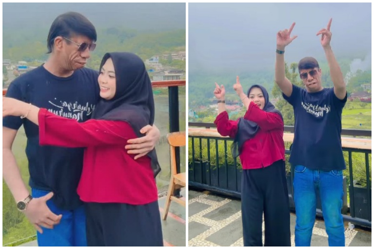 Dicibir kerjanya cuma joget di TikTok, Surya Manurung pengidap sindrom langka pamer bisa beli mobil