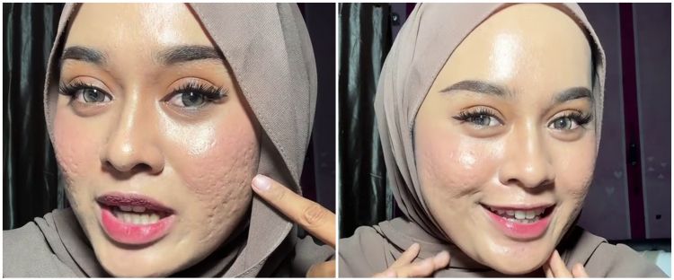 Bukan diset bedak padat, ini trik mengatasi makeup bertekstur agar lebih blurring pada wajah bopeng