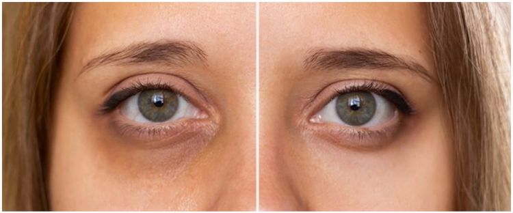 Tak perlu repot pakai eye mask, begini cara atasi mata panda secara alami pakai 1 bahan minuman