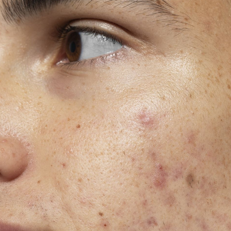 Trik memutihkan wajah kusam dan berflek hitam pakai 1 bahan makanan, nggak perlu pakai krim pemutih