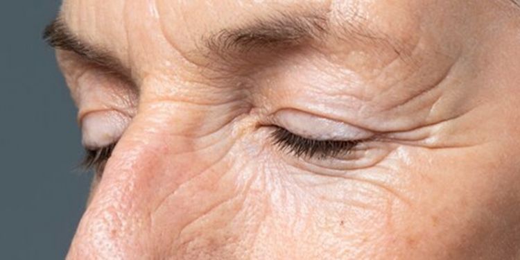 Cara pudarkan keriput pada wajah mengendur pakai 1 bubuk minuman, nggak usah beli minuman kolagen