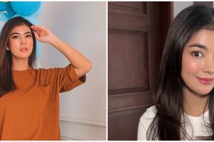 9 Potret before-after Raya Kohandi usai jalani operasi plastik, bentuk hidungnya jadi sorotan