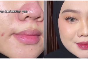 Kulit wajah bertekstur karena bruntusan Ini trik mengatasinya saat makeup agar hasilnya lebih halus