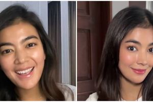 13 Seleb ini pilih oplas meski sudah cantik alami, ini potret sebelum dan sesudahnya