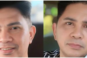 7 Potret Ronny Sianturi sebelum & sesudah operasi plastik di usia 60, wajah menolak tua, antikerutan