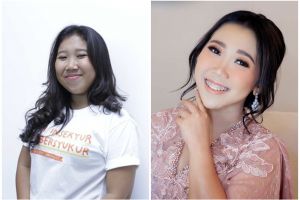 Potret wajah 15 seleb sebelum dan sesudah permak dagu, perubahannya drastis jadi tampak tirus