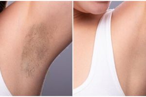 Auto cerah dan mulus dalam 1 minggu, cara atasi ketiak gelap ini ampuh pakai 1 bumbu dapur