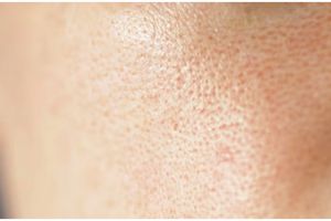 Tak perlu air beras, begini cara mengatasi pori-pori besar cuma dengan toner dari 1 bahan minuman