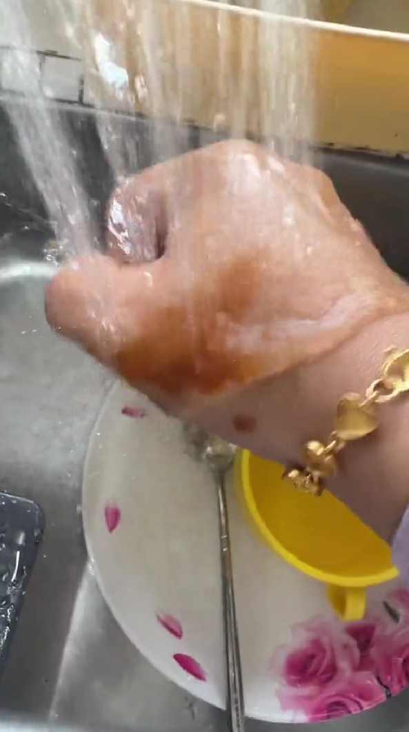 Trik agar tangan terkena minyak panas tak melepuh tanpa dioles pasta gigi, cuma pakai 1 bahan masakan