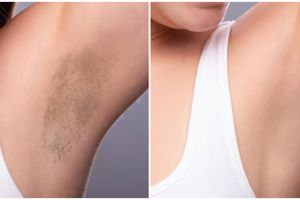 Tanpa lotion pemutih, ini cara atasi ketiak gelap agar lebih cerah cuma dengan 2 bahan dapur