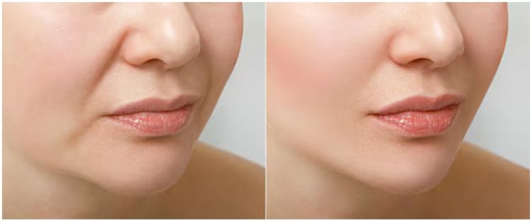 Tak perlu serum retinol, begini cara mengencangkan kulit agar bebas garis halus dengan modal Rp0