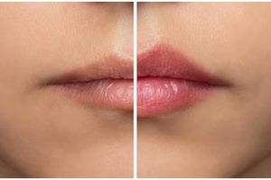 Cara bikin lip balm untuk cerahkan bibir hitam pakai 1 jenis bunga, nggak usah pakai madu dan beeswax