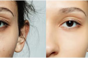 Wajah glowing saat Lebaran, ini cara alami hilangkan flek hitam dan garis halus dalam 7 hari