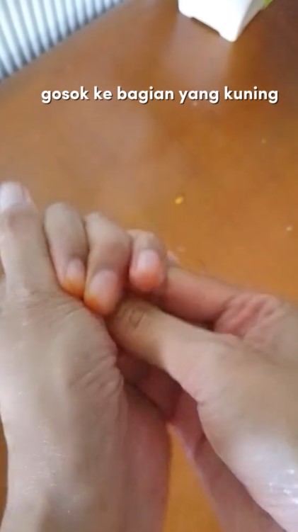 Bukan digosok alkohol, ini trik cepat hilangkan noda kunyit di kuku dan tangan pakai 1 bahan sederhana