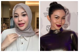 Transformasi 9 seleb sebelum & usai lakukan filler bibir, Femmy Permatasari rogoh kocek Rp300 juta