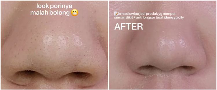 Pori-pori tampak bolong meski pakai skin prep? Ini trik mengatasinya agar complexion lebih blurring