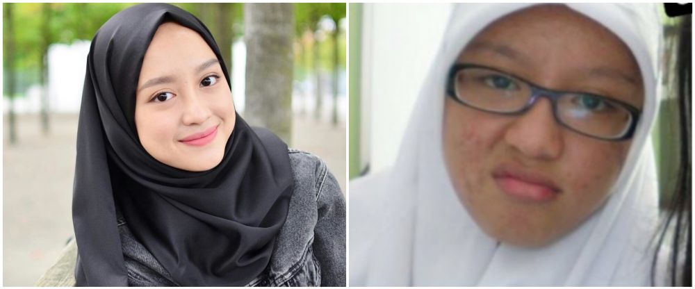 Potret 7 selebgram saat sekolah vs kini, Anya Geraldine bikin pangling banget