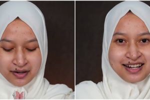 Padahal punya tahi lalat besar di bibir, transformasi makeup pengantin ini bikin lupa wajah asli