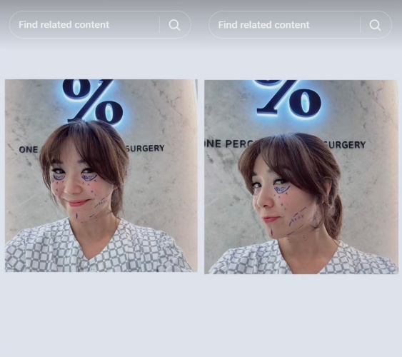 Gisella Anastasia jalani oplas ke Korea, netizen sebut sudah cantik tapi masih permak wajah