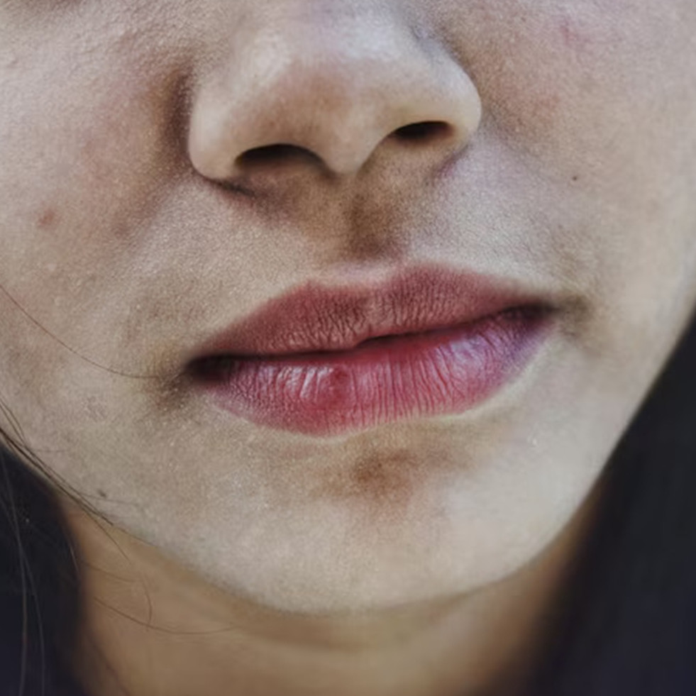 Tak butuh krim pemutih, ini cara mencerahkan area bibir hitam pakai masker dari 1 bahan makanan
