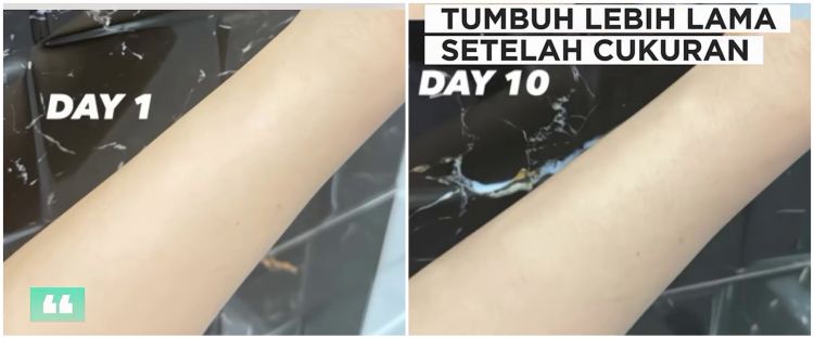 Trik agar kulit tangan selalu mulus usai waxing, bulu auto lama tumbuh dengan 2 jenis buah ini