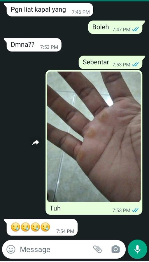 11 Jawaban lucu orang saat dikodein via chat ini endingnya malah bikin ngakak