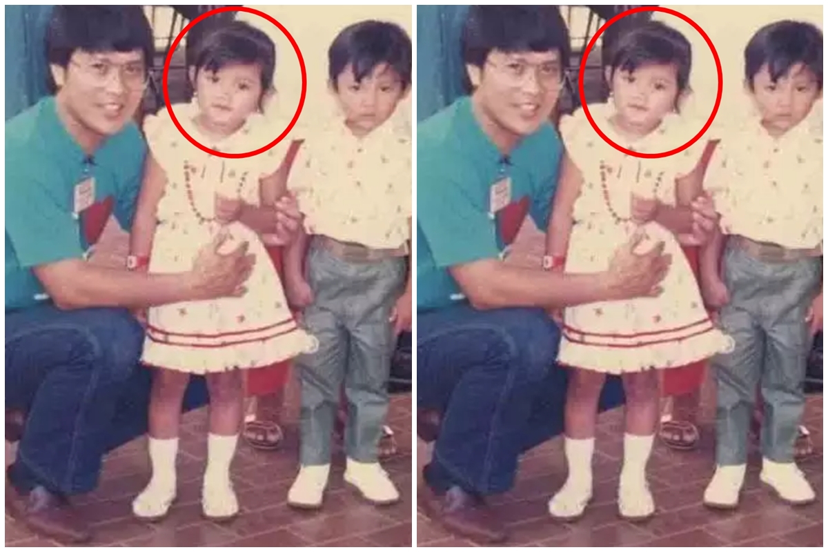 Bocah imut pernah foto bareng Kak Seto besarnya jadi pelawak top, begini 11 potret terbarunya