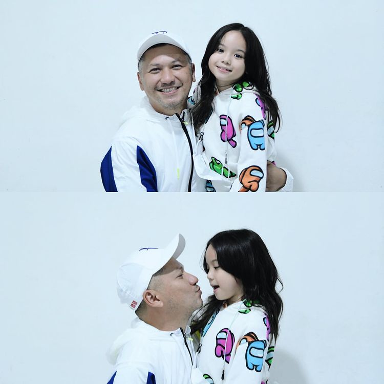 Bocah imut di iklan susu berbaju kuning ini kini sukses jadi artis, begini 11 potret terbarunya