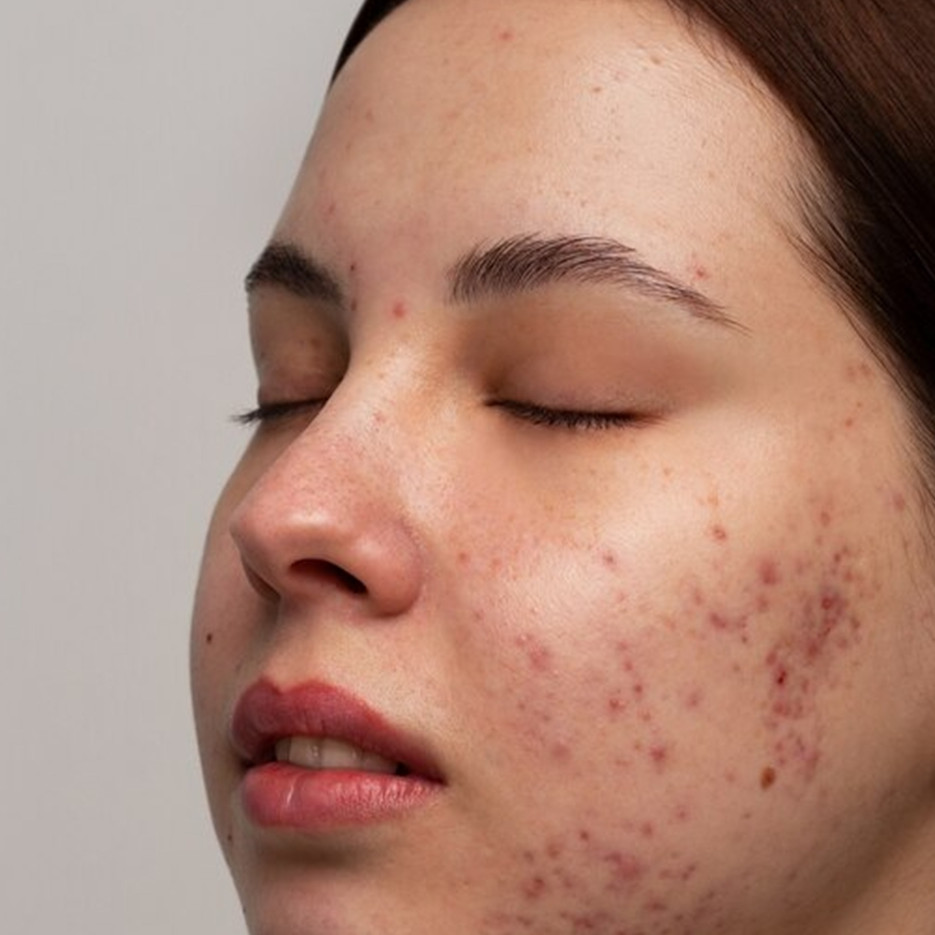 Cara samarkan pori-pori agar wajah bebas minyak cuma pakai 1 jenis minuman, nggak perlu touch-up bedak