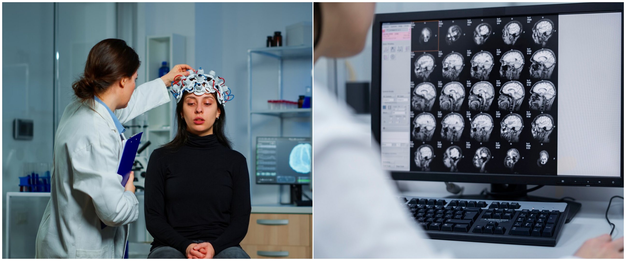 Perlu diwaspadai, ini 8 penyebab pendarahan otak yang sering tak disadari