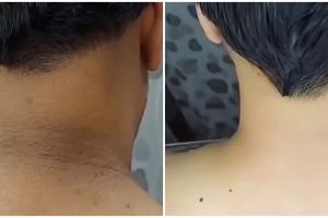 Cara mudah atasi punggung leher menghitam dan penuh lipatan ini auto mulus pakai 1 jenis minuman