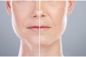 Cara alami hilangkan keriput dan garis halus ini bikin awet muda tanpa face lift, wajah auto glowing