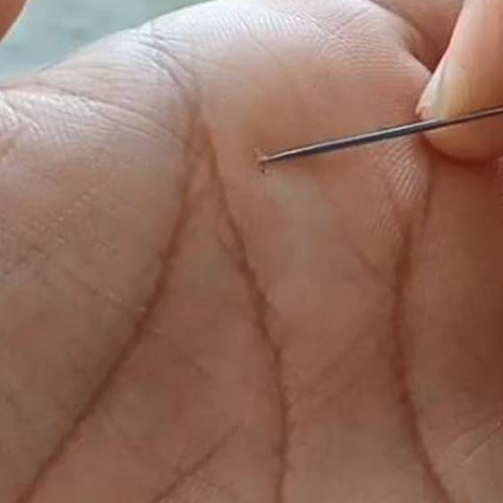 Trik keluarkan duri dari jari tangan tanpa rasa sakit ini andalkan 1 bumbu dapur, mudah dipraktikkan