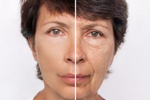 Cara hempas flek hitam agar kulit jadi flawless pakai 1 jenis topping minuman, wajah auto glowing