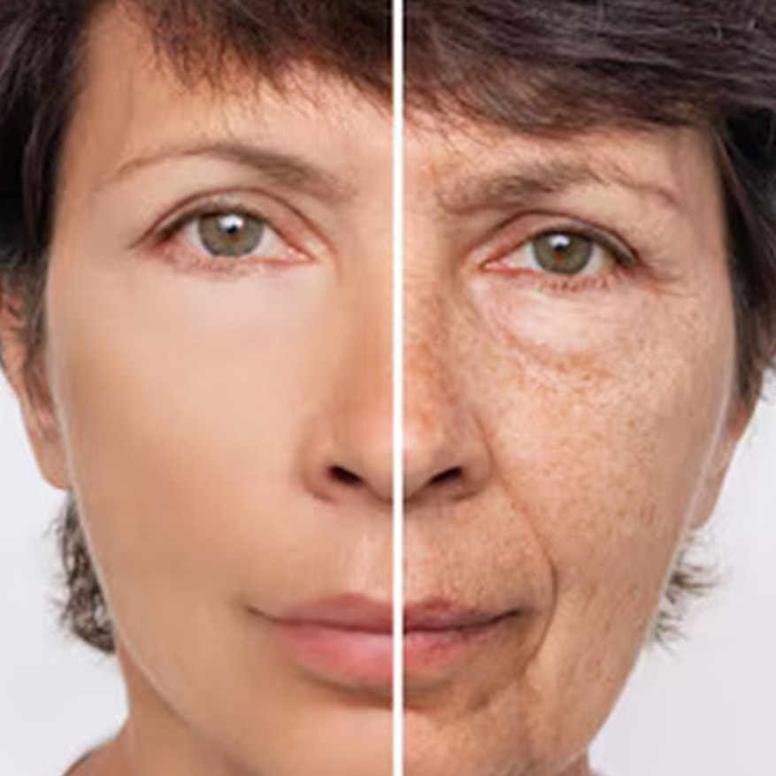 Cara hempas flek hitam agar kulit jadi flawless pakai 1 jenis topping minuman, wajah auto glowing