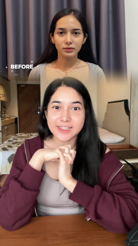 9 Potret Dilan Janiyar seleb TikTok usai oplas di Korea, tak banyak berubah tetap cantik natural
