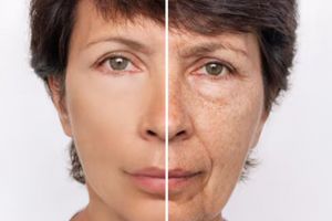 Sekarang nggak perlu khawatir, ternyata membersihkan pori-pori wajah bisa pakai ampas minuman