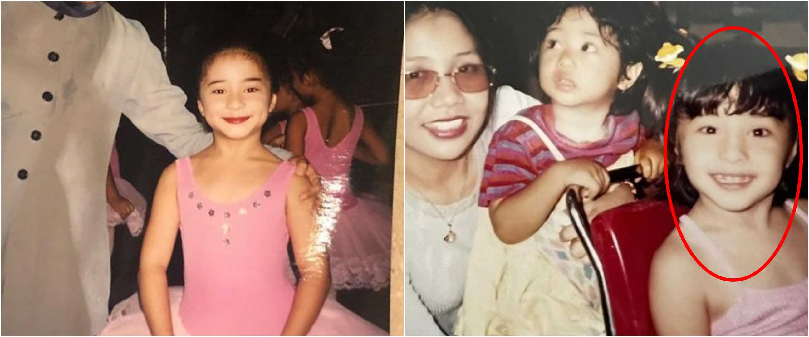 Padahal parasnya imut, bocah ini dulunya ditolak gegara giginya jelek kini sukses jadi pesinetron top