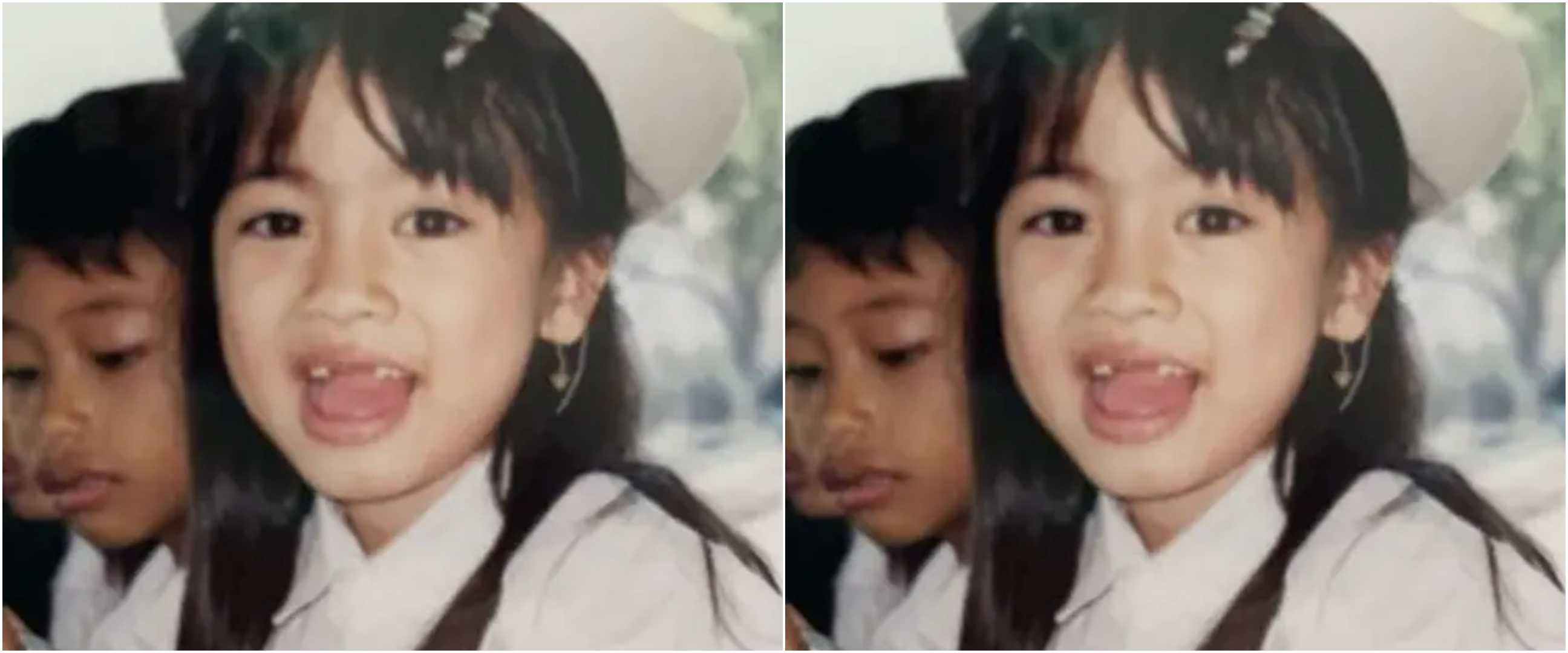 Bocah ompong ini dulunya pesinetron kondang, kini malah sukses jadi bos skincare