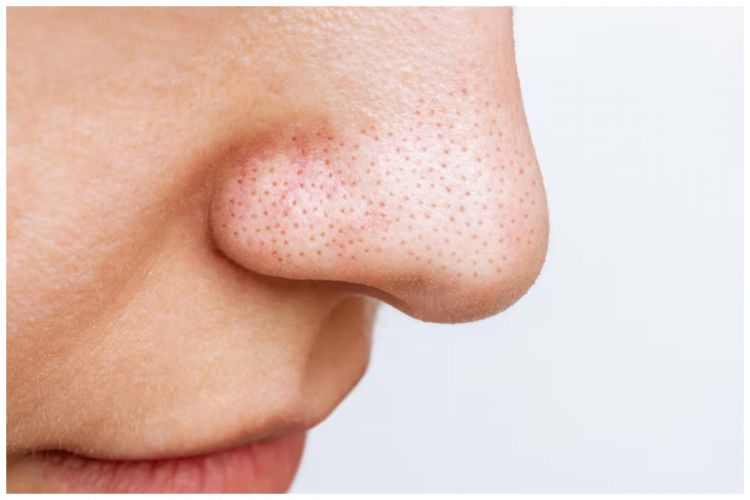 Ternyata ampas buah ini bisa dijadikan toner antiaging untuk kecilkan pori-pori, begini cara buatnya