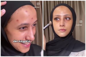 Punya bekas luka cacar, transformasi makeup pengantin dirias classic ini endingnya menawan bak bule