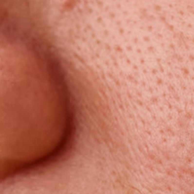 Ternyata begini cara bikin ukuran pori-pori mengecil pakai 2 jeni buah, wajah mulus bebas komedo