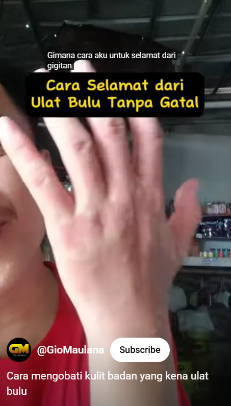 Trik agar kulit tak gatal dan nyeri usai digigit ulat bulu, sekarang atasi pakai 2 bahan dapur