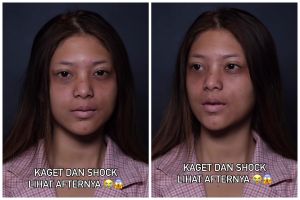 Afternya bak beda orang, transformasi cewek bibir pucat usai dirias ini jadi fresh dan plumpy